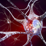 Utilizing Advanced Science to Improve the Quality of Life in Patients with Parkinson’s Disease