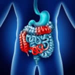 Clinical Updates for the Optimal Management of Patients with Inflammatory Bowel Disease