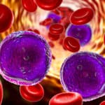 Applying Novel Pharmacotherapies to Improve Outcomes in Patients with Acute Leukemia