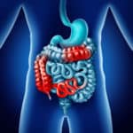 Advances in Sphingosine-1-phosphate (S1P) Therapeutics to Improve Outcomes in Patients with Inflammatory Bowel Disease