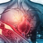 Optimal Guideline Directed Medical Therapy for Heart Failure